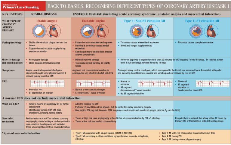 Back To Basics Recognising Different Types Of Coronary Artery Disease Issues And Answers