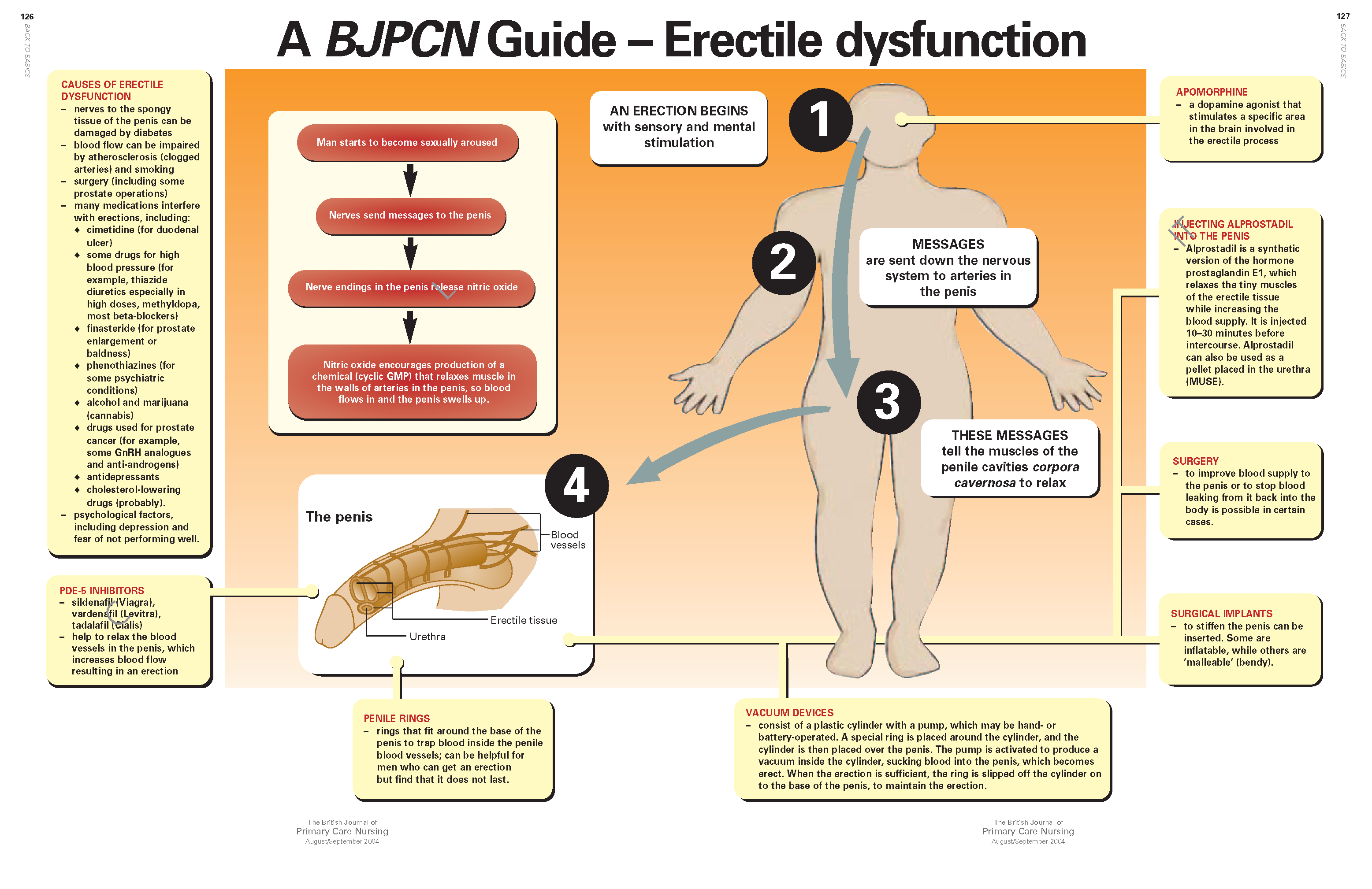 Back to Basics A BJPCN Guide Erectile dysfunction Issues and