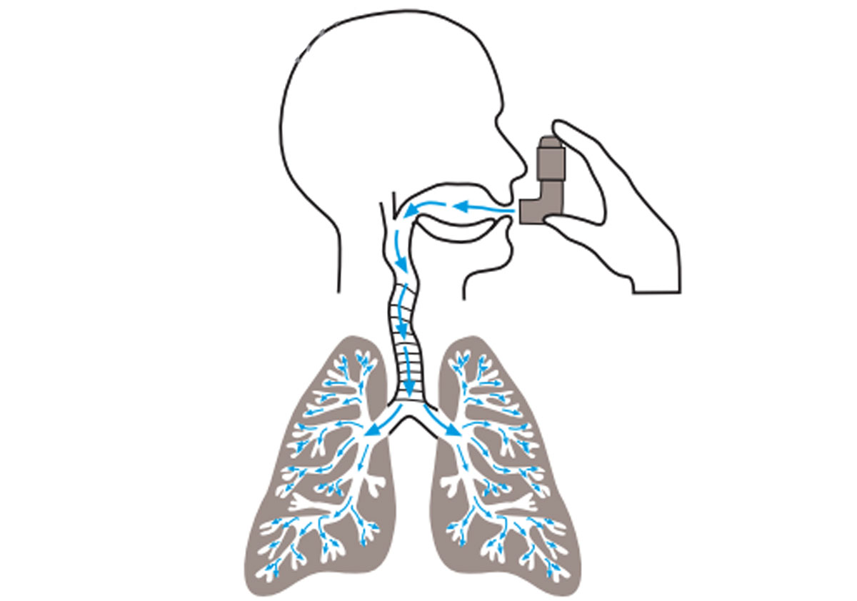 Why Optimise Inhaler Technique in Asthma and COPD? - Issues and Answers